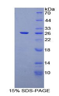 Recombinant Cluster Of Differentiation 72 (CD72)