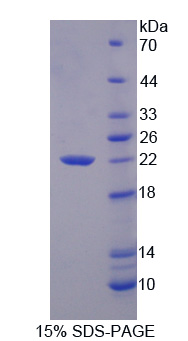 Recombinant Glucagon (GCG)