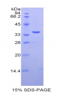Recombinant Sulfotransferase 1A1 (SULT1A1)