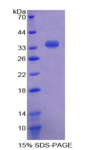 Recombinant Sulfotransferase 1A1 (SULT1A1)