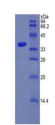 Recombinant Sulfotransferase 1A1 (SULT1A1)