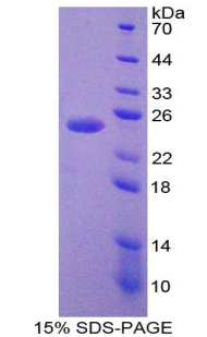 Recombinant ATP Dependent DNA ligase I (LIG1)