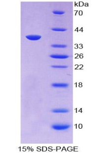 Recombinant ATP Dependent DNA ligase I (LIG1)