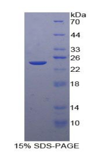 Recombinant Fc Fragment Of IgG Low Affinity IIIb Receptor (FcgR3B)