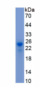 Recombinant Progesterone Receptor (PGR)