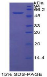 Recombinant Membrane Cofactor Protein (MCP)