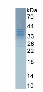 Recombinant Fc Fragment Of IgG Low Affinity IIIa Receptor (FcgR3A)