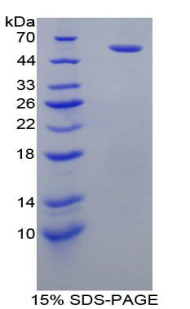 Recombinant Fc Fragment Of IgG Low Affinity IIIa Receptor (FcgR3A)