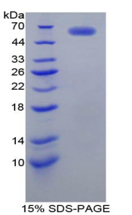 Recombinant Cathepsin D (CTSD)