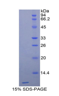 Recombinant Cathepsin D (CTSD)