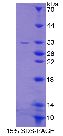 Recombinant Integrin Alpha V (ITGaV)