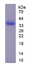 Recombinant Epithelial Cell Adhesion Molecule (EPCAM)