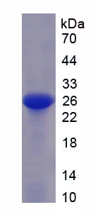 Recombinant Acetyl Coenzyme A Carboxylase Alpha (ACACa)