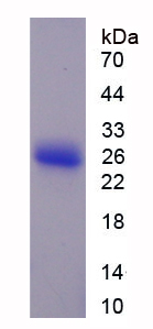 Recombinant Acetyl Coenzyme A Carboxylase Alpha (ACACa)