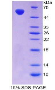 Recombinant V-Fos FBJ Murine Osteosarcoma Viral Oncogene Homolog (FOS)