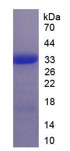 Recombinant V-Jun Sarcoma Virus 17 Oncogene Homolog (JUN)