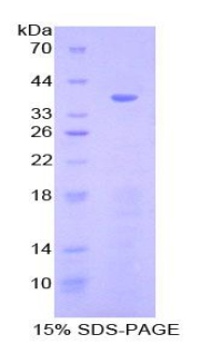 Recombinant Ezrin (EZR)