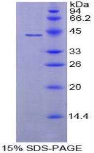 Recombinant Complement Component 8b (C8b)