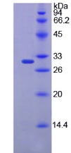 Recombinant Chymotrypsin C (CTRC)