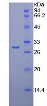 Recombinant Chymotrypsin C (CTRC)