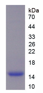 Recombinant Secretory Leukocyte Peptidase Inhibitor (SLPI)