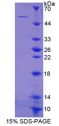 Recombinant Glutathione Reductase (GR)