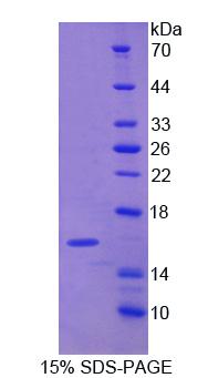 Recombinant Caldesmon (CALD)