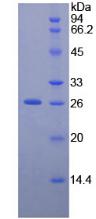 Recombinant Neurofilament 3 (NEF3)