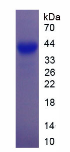 Recombinant Growth Associated Protein 43 (GAP43)