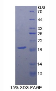 Recombinant Cluster of Differentiation 59 (CD59)