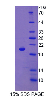 Recombinant Cluster of Differentiation 59 (CD59)