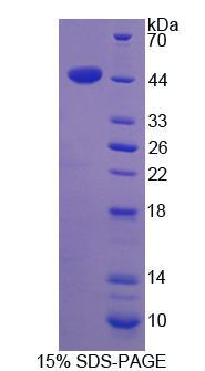 Recombinant Actin Gamma 2, Smooth Muscle (ACTg2)