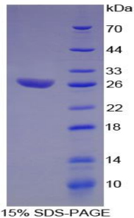 Recombinant Activating Transcription Factor 1 (ATF1)