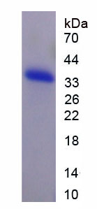 Recombinant Adenylate Cyclase 1, Brain (ADCY1)