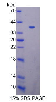 Recombinant Macrophage Expressed Gene 1 Protein (MPG1)