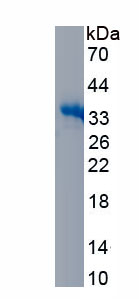 Recombinant Aryl Hydrocarbon Receptor (AhR)