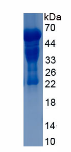 Recombinant Aryl Hydrocarbon Receptor (AhR)