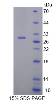 Recombinant Acid Sphingomyelinase (ASM)