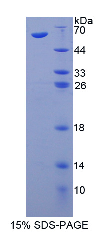 Recombinant Ataxia Telangiectasia Mutated (ATM)