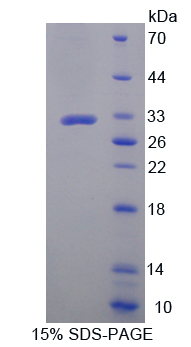 Recombinant Ataxia Telangiectasia Mutated (ATM)