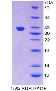 Recombinant Glucokinase Regulatory Protein (GKRP)