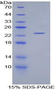 Recombinant Glucokinase Regulatory Protein (GKRP)