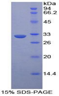 Recombinant Ephrin Type A Receptor 1 (EPHA1)