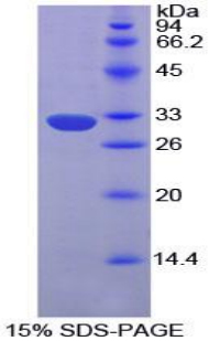 Recombinant Ephrin Type A Receptor 1 (EPHA1)