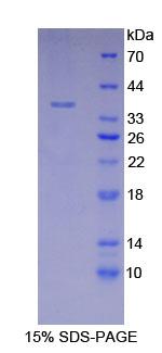 Recombinant Lactate Dehydrogenase A (LDHA)