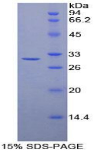 Recombinant Transaldolase (TALDO1)