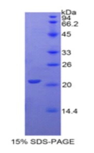 Recombinant Gamma-Glutamyltransferase 1 (gGT1)