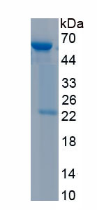 Recombinant Gamma-Glutamyltransferase 1 (gGT1)