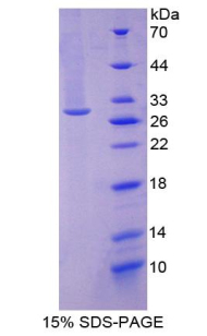 Recombinant Gamma-Glutamyltransferase 1 (gGT1)