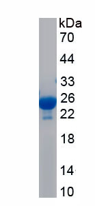 Recombinant Immune Receptor Expressed On Myeloid Cells 1 (IREM1)